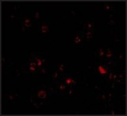 Anti-DDX3 antibody produced in rabbit affinity isolated antibody, buffered aqueous solution