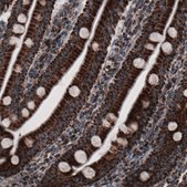 Monoclonal Anti-CS antibody produced in mouse Prestige Antibodies&#174; Powered by Atlas Antibodies, clone CL2561, purified immunoglobulin, buffered aqueous glycerol solution