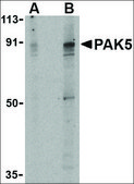 Anti-PAK5 antibody produced in rabbit affinity isolated antibody, buffered aqueous solution