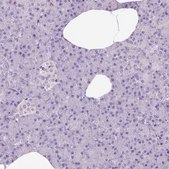 Anti-SYN1 antibody produced in rabbit Prestige Antibodies&#174; Powered by Atlas Antibodies, affinity isolated antibody, buffered aqueous glycerol solution