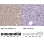 Anti-SYT1 antibody produced in rabbit Prestige Antibodies&#174; Powered by Atlas Antibodies, affinity isolated antibody, buffered aqueous glycerol solution
