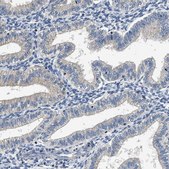 Anti-INHA antibody produced in rabbit Prestige Antibodies&#174; Powered by Atlas Antibodies, affinity isolated antibody, buffered aqueous glycerol solution