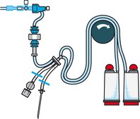 Steritest® NEO Device For medical devices and collapsible bags., Red base canister provided with 3 needle adapters to connect to a variety of test devices., pkg of 10 blisters per box, Single packed