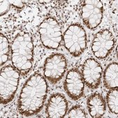 Anti-RCC1 antibody produced in rabbit Prestige Antibodies&#174; Powered by Atlas Antibodies, affinity isolated antibody, buffered aqueous glycerol solution, ab2