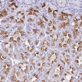 Anti-ATP4B antibody produced in rabbit Prestige Antibodies&#174; Powered by Atlas Antibodies, affinity isolated antibody, buffered aqueous glycerol solution