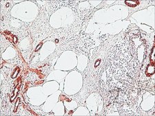 Anti-Mouse IgG (Fc specific)–Peroxidase antibody produced in goat affinity isolated antibody, buffered aqueous solution