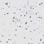 Anti-NFIA antibody produced in rabbit Prestige Antibodies&#174; Powered by Atlas Antibodies, affinity isolated antibody, buffered aqueous glycerol solution