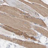 Anti-CA14 antibody produced in rabbit Prestige Antibodies&#174; Powered by Atlas Antibodies, affinity isolated antibody, buffered aqueous glycerol solution