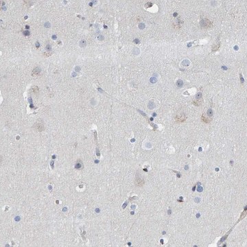 Anti-MMP16 antibody produced in rabbit Prestige Antibodies&#174; Powered by Atlas Antibodies, affinity isolated antibody, buffered aqueous glycerol solution