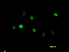 Monoclonal Anti-ANXA5 antibody produced in mouse clone 1F4-1A5, purified immunoglobulin, buffered aqueous solution