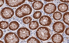 Anti-NQO1 Antibody, clone 1D12 ZooMAb® Rabbit Monoclonal recombinant, expressed in HEK 293 cells