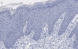 Anti-Claudin-1 Antibody, clone 1O12 ZooMAb&#174; Rabbit Monoclonal recombinant, expressed in HEK 293 cells