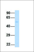 Anti-XK (ab2) antibody produced in rabbit affinity isolated antibody