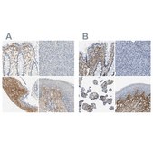 Anti-TGFBI antibody produced in rabbit Prestige Antibodies&#174; Powered by Atlas Antibodies, affinity isolated antibody, buffered aqueous glycerol solution