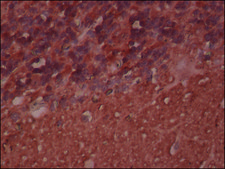 Anti-Neuron-Specific Enolase (NSE), Mouse monoclonal clone NSE-P1, purified from hybridoma cell culture