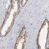 Anti-MIF antibody produced in rabbit Prestige Antibodies&#174; Powered by Atlas Antibodies, affinity isolated antibody, buffered aqueous glycerol solution