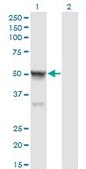 Monoclonal Anti-CASQ2 antibody produced in mouse clone 1B6, purified immunoglobulin, buffered aqueous solution