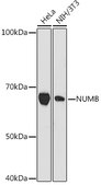 Anti-NUMB Antibody, clone 9X1Y0, Rabbit Monoclonal