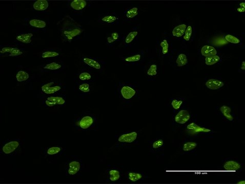 Anti-NCL antibody produced in mouse purified immunoglobulin, buffered aqueous solution