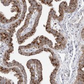 Anti-ATPIF1 antibody produced in rabbit Prestige Antibodies&#174; Powered by Atlas Antibodies, affinity isolated antibody, buffered aqueous glycerol solution