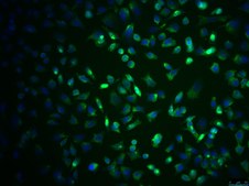 SCp2 Mouse Mammary Epithelial Cell Line