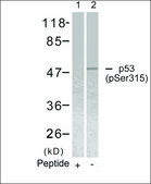 Anti-phospho-TP53 (pSer315) antibody produced in rabbit affinity isolated antibody