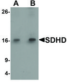 Anti-SDHD antibody produced in rabbit affinity isolated antibody, buffered aqueous solution