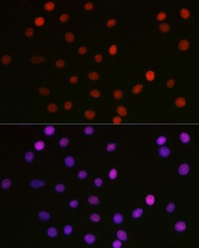 Anti- Acetyl-HMGB1-K29 antibody produced in rabbit