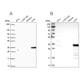 Anti-SULT2A1 antibody produced in rabbit Prestige Antibodies&#174; Powered by Atlas Antibodies, affinity isolated antibody, buffered aqueous glycerol solution