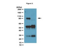 ChIPAb+ EZH2, clone AC22 - ChIP Validated Antibody and Primer Set clone AC22, from mouse