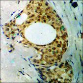 Anti-phospho-XIAP (pSer87) antibody produced in rabbit affinity isolated antibody