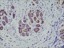 Anti-S100-beta antibody, Rabbit Monoclonal recombinant, expressed in HEK 293 cells, clone RM304, purified immunoglobulin