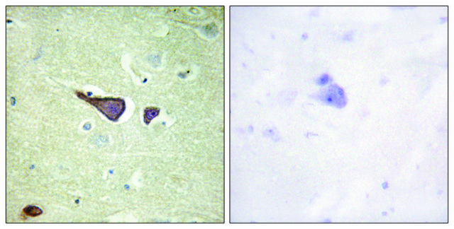 Anti-IGF2R antibody produced in rabbit affinity isolated antibody
