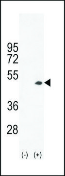 ANTI-CREATINE KINASE B(C-TERMINAL) antibody produced in rabbit IgG fraction of antiserum, buffered aqueous solution