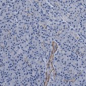 Anti-PARG antibody produced in rabbit Prestige Antibodies&#174; Powered by Atlas Antibodies, affinity isolated antibody, buffered aqueous glycerol solution