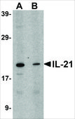 Anti-IL-21 antibody produced in rabbit affinity isolated antibody, buffered aqueous solution