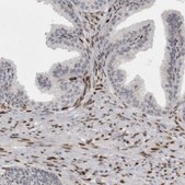 Anti-ZEB1 antibody produced in rabbit Prestige Antibodies&#174; Powered by Atlas Antibodies, affinity isolated antibody, buffered aqueous glycerol solution