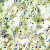 Anti-phospho-SYK (pTyr348) antibody produced in rabbit affinity isolated antibody