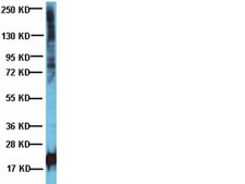 Anti-Phosphothreonine Antibody Chemicon&#174;, from rabbit