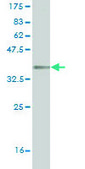 Monoclonal Anti-MKI67 antibody produced in mouse clone 7B8, purified immunoglobulin, buffered aqueous solution