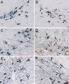 Anti-Tyrosine Hydroxylase Antibody, clone LNC1 ascites fluid, clone LNC1, Chemicon&#174;
