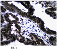 Anti-Twist1 (Twist-related protein 1) Antibody from rabbit, purified by affinity chromatography