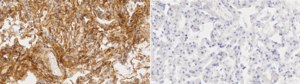 Anti-S100-A10 Antibody, clone 2D23 ZooMAb&#174; Rabbit Monoclonal recombinant, expressed in HEK 293 cells