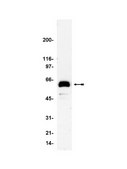 Anti-Paxillin Antibody, clone 5H11 clone 5H11, Upstate&#174;, from mouse