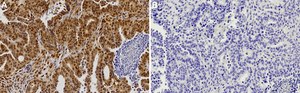 Anti-Estrogen Receptor &#945; Antibody from rabbit, purified by affinity chromatography