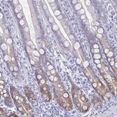 Anti-CA9 antibody produced in rabbit Prestige Antibodies&#174; Powered by Atlas Antibodies, affinity isolated antibody, buffered aqueous glycerol solution