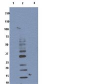 Anti-Ubiquitin Antibody, Lys63-Specific, clone HWA4C4 clone HWA4C4, from mouse