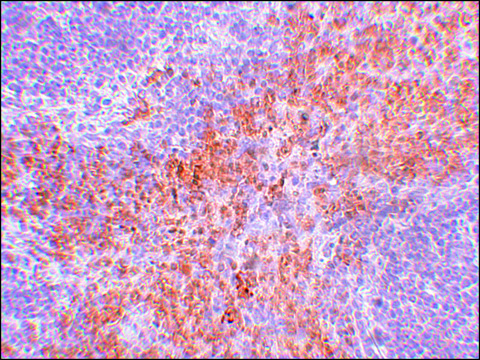 Anti-RIPK1 antibody produced in rabbit affinity isolated antibody, buffered aqueous solution