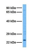 Anti-ATF3 antibody produced in rabbit affinity isolated antibody