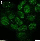 Anti-hnRNP A1 Antibody, clone 1I21 ZooMAb&#174; Rabbit Monoclonal recombinant, expressed in HEK 293 cells